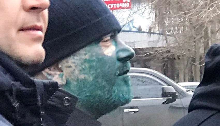 ""
